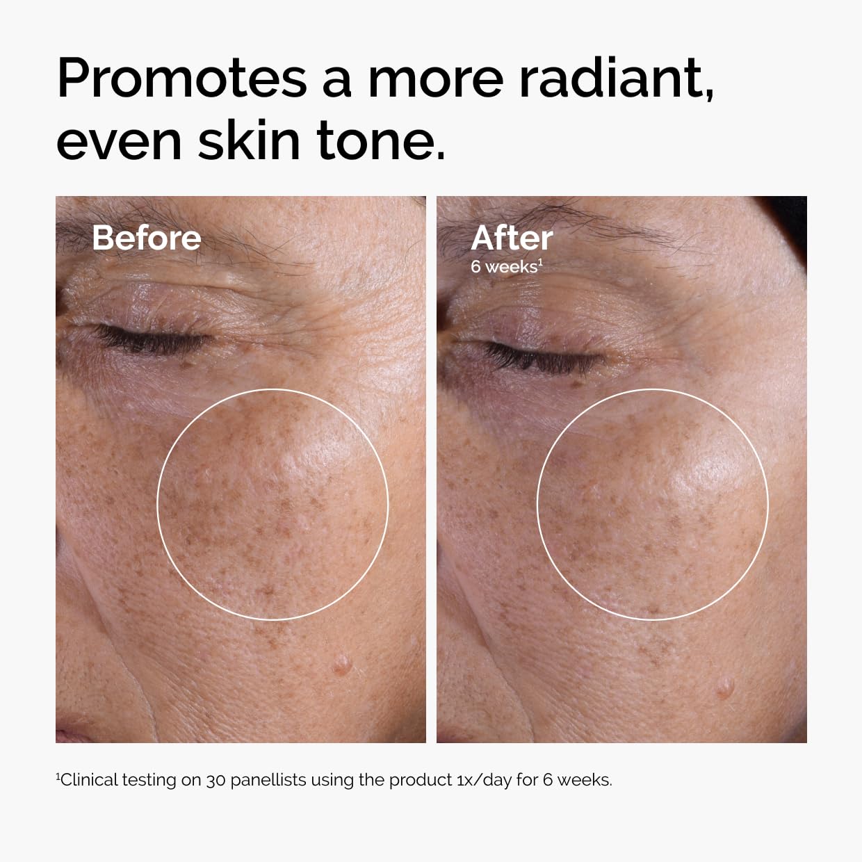 ChatGPT: The Ordinary Glycolic Acid 7% Toner gently exfoliates for brighter, smoother, and more even skin tone.