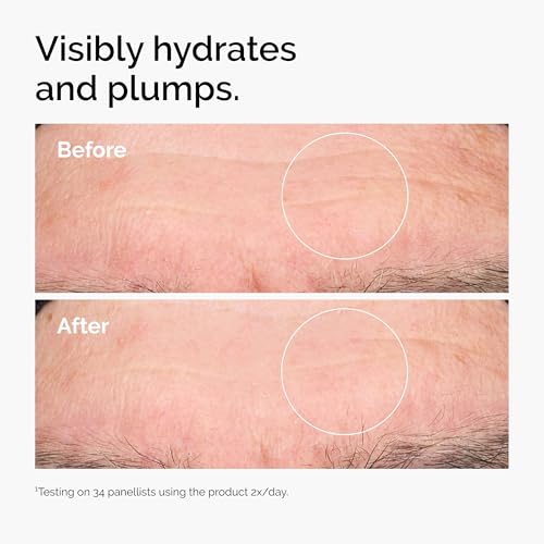Hyaluronic Acid 2% + B5 serum with ceramides provides multi-depth hydration for plumper,