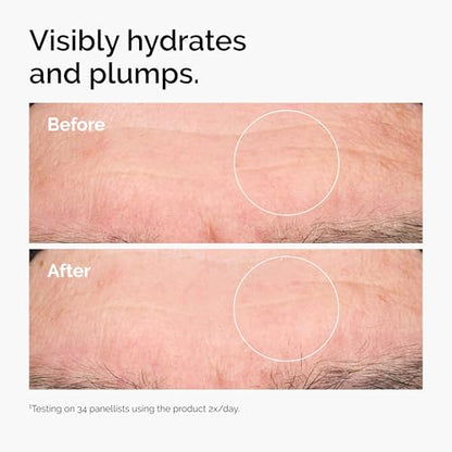 Hyaluronic Acid 2% + B5 serum with ceramides provides multi-depth hydration for plumper,
