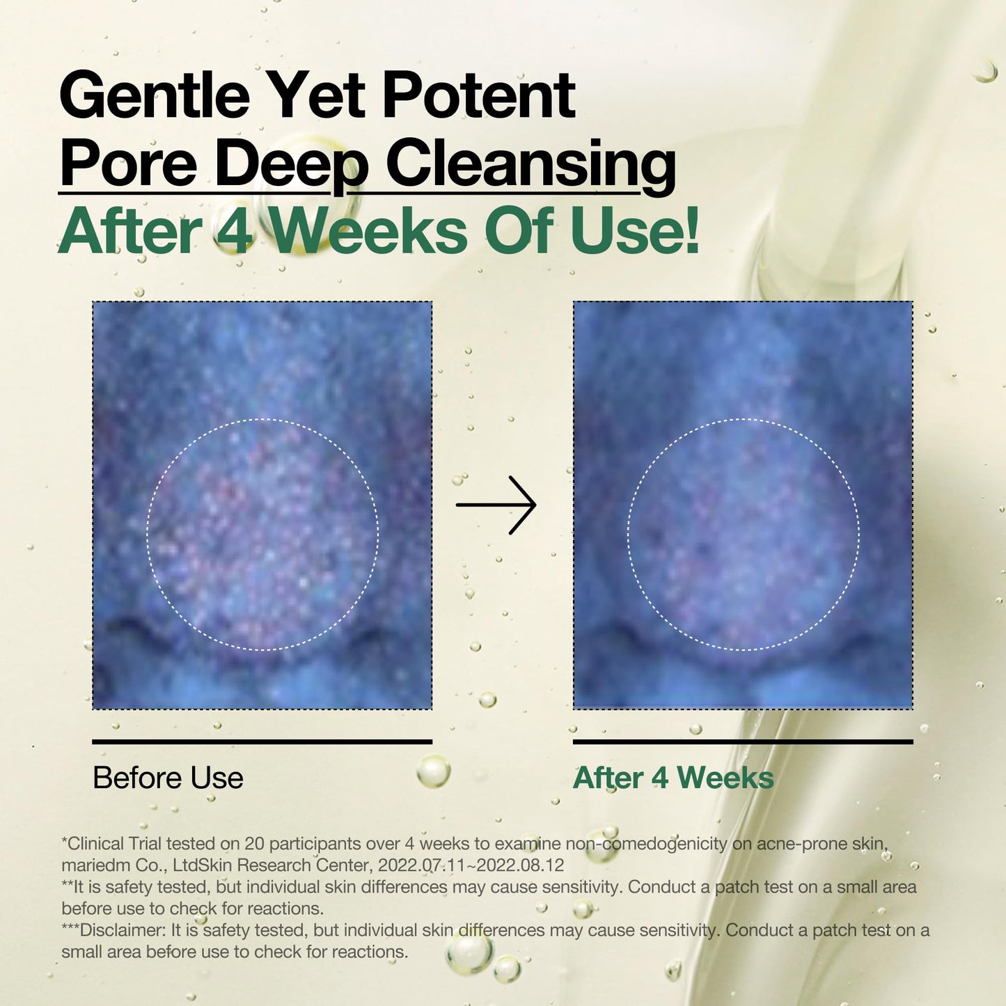 Anua Heartleaf Cleansing Oil removes makeup, blackheads, and controls pores.
