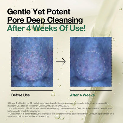 Anua Heartleaf Cleansing Oil removes makeup, blackheads, and controls pores.